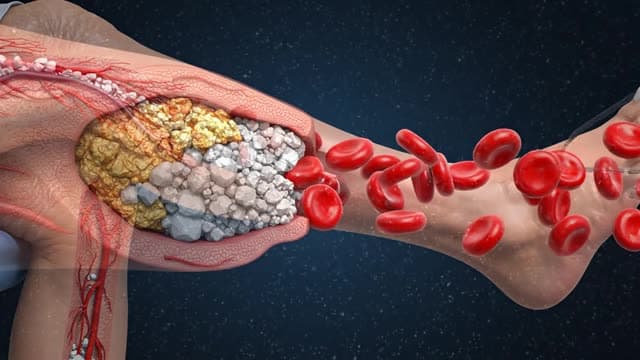 Create a 8-second, high-quality, photorealistic 3D medical animation explaining below-the-knee arter